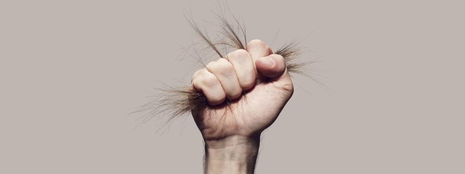 balding and exercise