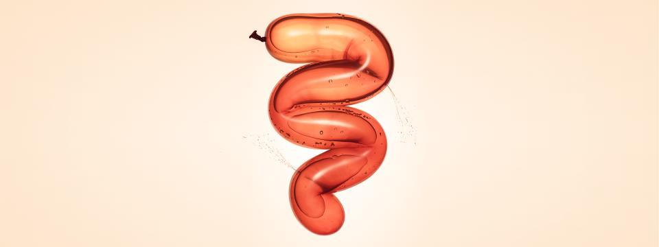 3 QUESTIONS FOR A GASTROENTEROLOGIST